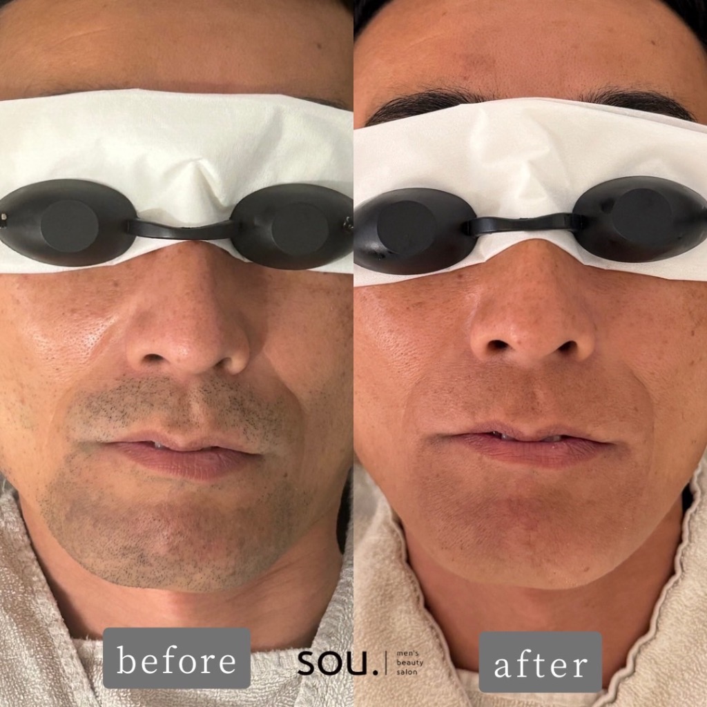  ＼もうこれ以上悩まなくて大丈夫です！／